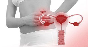 بیماری-التهابی-لگن-(Pelvic-inflammatory-disease)