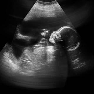 سونوگرافی هفته بیست و سوم بارداری